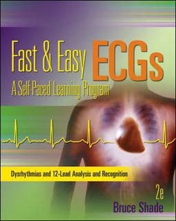 Fast and Easy ECGs: a Self-Paced Learning Program 9780073519753