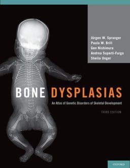 Bone Dysplasias 9780195396089