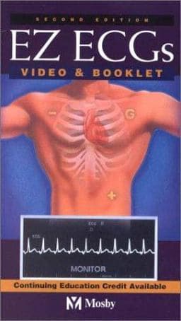 EZ ECGs 9780323013307