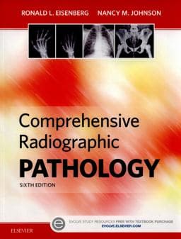 Comprehensive Radiographic Pathology 9780323353243