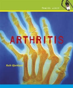 Arthritis 9780761439844