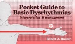 Basic Dysrhythmias Pocket Guide 9780815147466