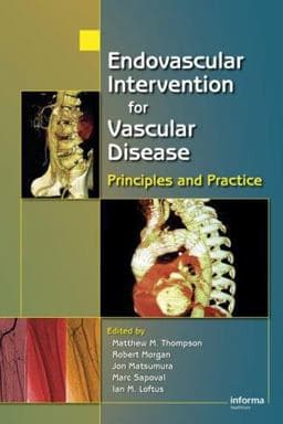 Endovascular Intervention for Vascular Disease 9780849339790
