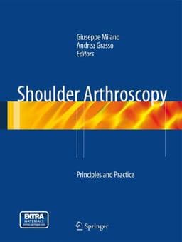 Shoulder Arthroscopy 9781447154273