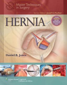 Master Techniques in Surgery: Hernia 9781451107166