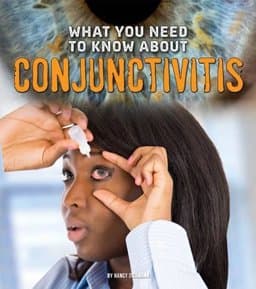 What You Need to Know about Conjunctivitis 9781474711913