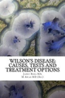Wilson's Disease: Causes, Tests and Treatment Options 9781497363571