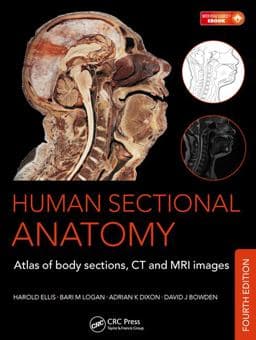 Human Sectional Anatomy 9781498703604