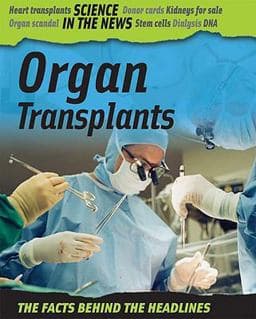 Organ Transplants 9781599203218
