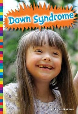 Down Syndrome 9781607534815