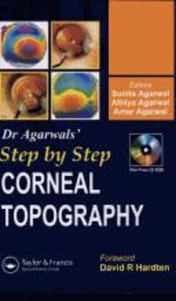 Step by Step Corneal Topography 9781841845470