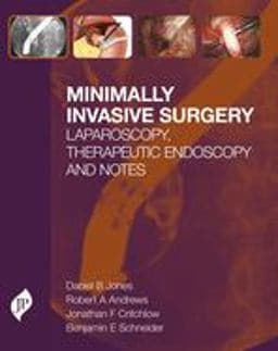 Minimally Invasive Surgery 9781907816192