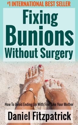 Fixing Bunions with Out Surgery 9781945176432