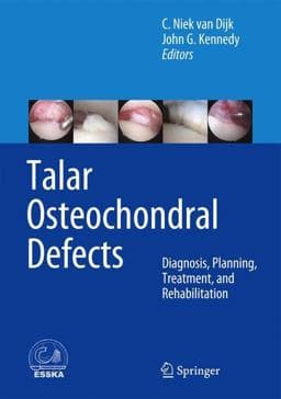 Talar Osteochondral Defects 9783642450969