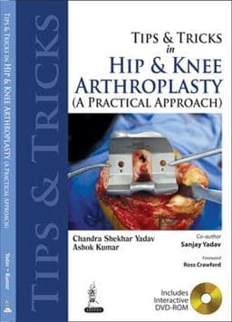 Tips and Tricks in Hip and Knee Arthroplasty 9789350256473