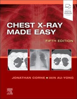 Chest X-Ray Made Easy 9780702082344