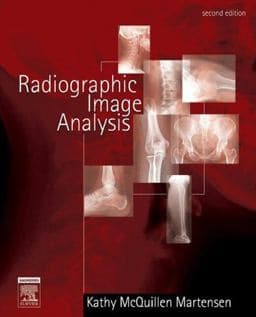 Radiographic Image Analysis 9780721639253