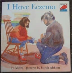 I Have Eczema 9780851227122