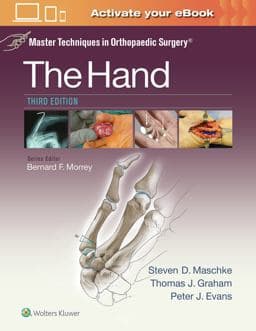 Master Techniques in Orthopaedic Surgery: the Hand 9781451182781