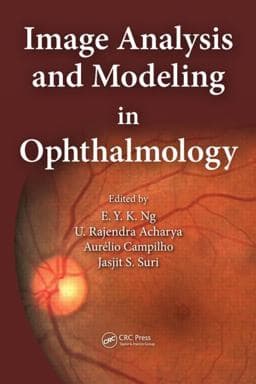 Image Analysis and Modeling in Opthalmology 9781466559301