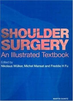 Shoulder Surgery 9781853175633