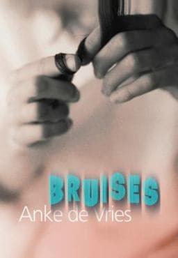 Bruises 9781886910034