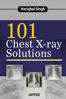 101 Chest X-Ray Solutions 9789350904626