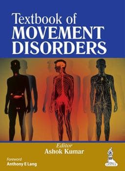 Textbook of Movement Disorders 9789350906408